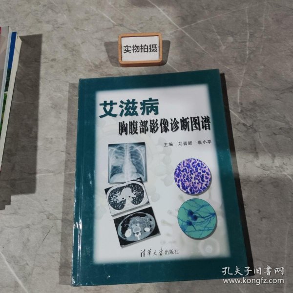 艾滋病胸腹部影像诊断图谱