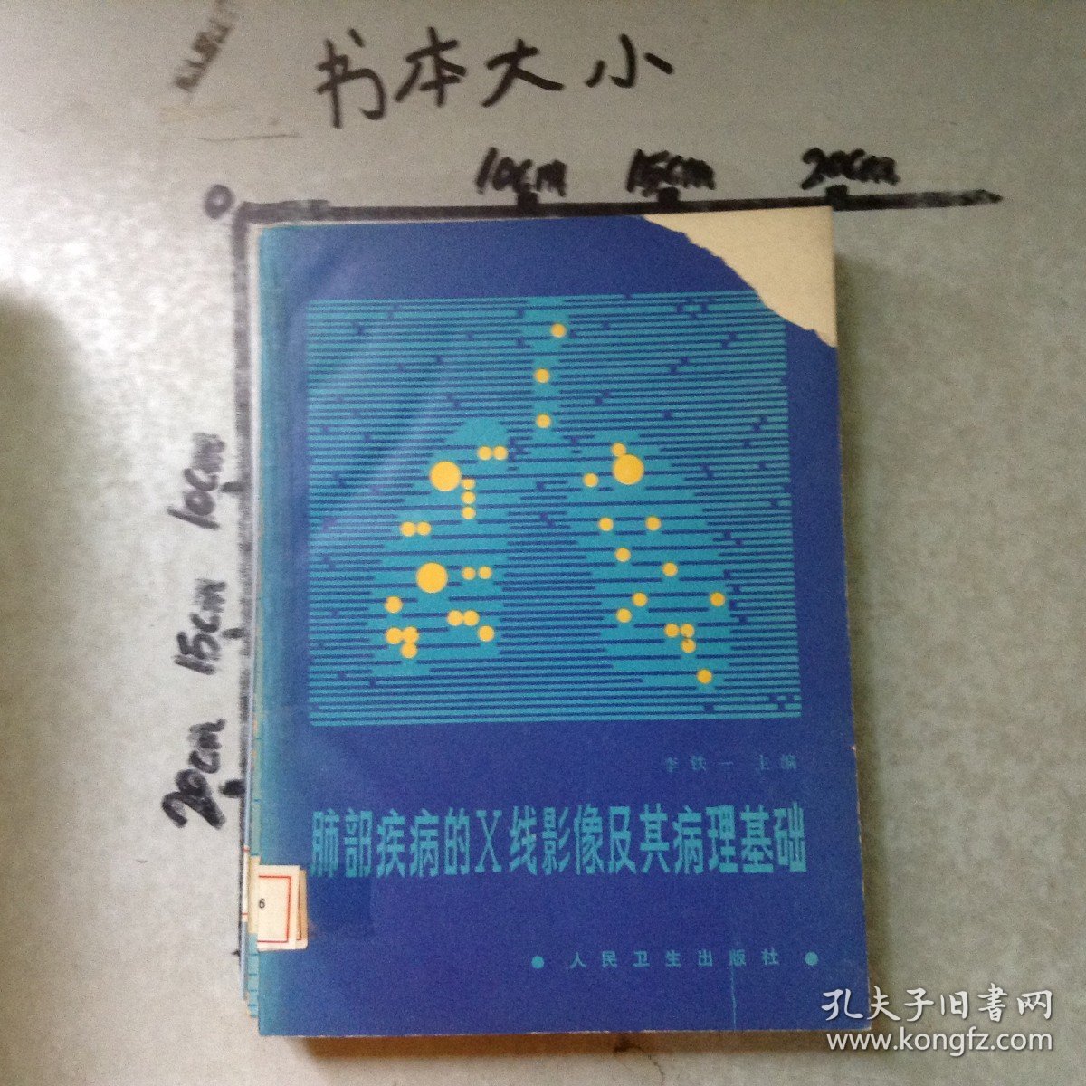 肺部疾病的X线影像及其病理基础