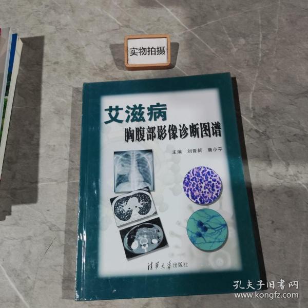 艾滋病胸腹部影像诊断图谱