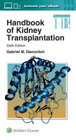 现货 肾移植手册Handbook of Kidney Transplantation