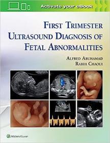 现货 怀孕前三个月超声诊断胎儿畸形First Trimester Ultrasound Diagnosis of Fetal Abnormalities