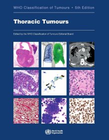 现货 胸部肿瘤 Thoracic Tumours: WHO Classification of Tumours