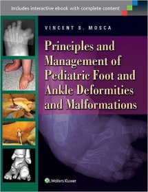 现货 小儿足踝畸形和畸形的原理与处理Principles and Management of Pediatric Foot and Ankle Deformities and Malformations