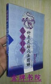 正版 常见百病针灸点按穴法图解 修订版 王毅刚编著 常用穴位