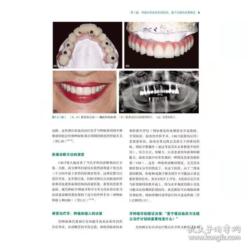 【正版现货】口腔种植临床决策 外科手术和修复方案图集