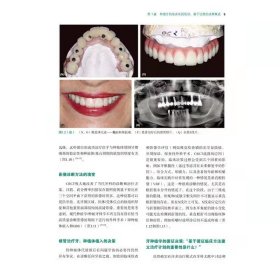 【正版现货】口腔种植临床决策 外科手术和修复方案图集