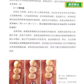 口腔种植的精准二期手术和取模技巧和口腔种植的精准植入技巧套装