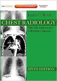 现货Chest Radiology: Plain Film Patterns and Differential Diagnoses [With Access Code] (Expert Consult Title: Online + Print)[9781437723458]