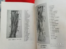 小儿麻痹后遗症穴位刺激结扎疗法（有毛主席语录，有黑白插图穴位结扎病例。 请看实拍图）1970年一版一印