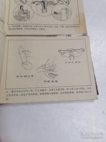 婚育知识画册:孕期卫生与保健 节育与避孕 妇女常见病防治 3合售
