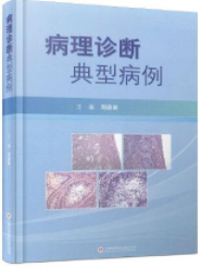 病理诊断：典型病例