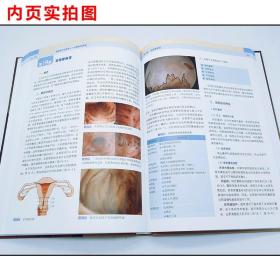 正版 宫腔镜下的世界 从解剖到病理 冯力民著 中国协和医科出版社9787567909663