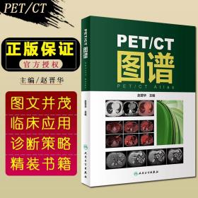 PET/CT图谱