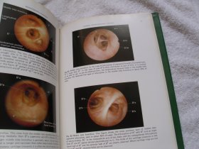 Practical Fiberoptic Bronchoscopy（实用纤维支气管镜检查 精装）