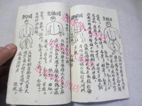 《江西南昌伤科点穴及诸病治疗秘法》胡锦彪抄,中医伤科书