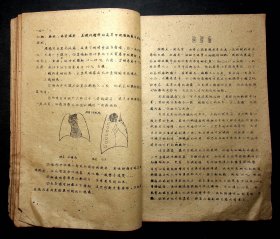 油印；1960年南京市结核病防治院放射线训练班《纵隔疾患》