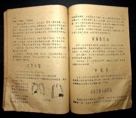 油印；1960年南京市结核病防治院放射线训练班《纵隔疾患》