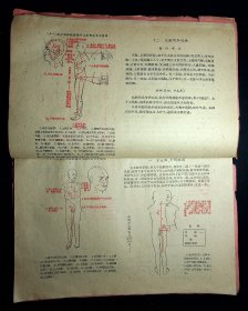 1959年《针灸学讲义》