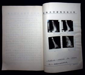 1990年东南大学闾坚强学位论文《X线投影片的双能量减影研究》