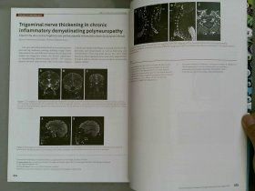 Arquivos de Neuro-Psiquiatria 2015/07 VOL.73 NO.7 医学学术英文杂志期刊