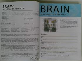 BRAIN A JOURNAL OF NEUROLOGY 2013/04 英文原版脑神经科学杂志