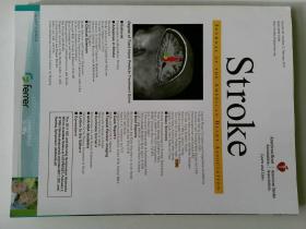 American Stroke Association 2011年2月 美国中风原版外文杂志卒中 医学杂志