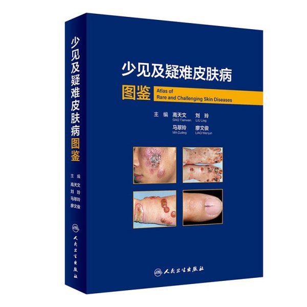 少见及疑难皮肤病图鉴