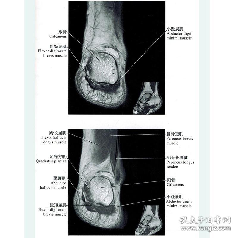 正版 正常关节磁共振解剖图谱  临床医师影像科医师骨关节磁共振 医学影像学解剖图谱丛书 李明华 姚伟武主编 上海科学技术出版社