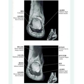 正版 正常关节磁共振解剖图谱  临床医师影像科医师骨关节磁共振 医学影像学解剖图谱丛书 李明华 姚伟武主编 上海科学技术出版社