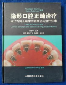 隐形口腔正畸治疗：当代舌侧正畸学的新概念与治疗技术