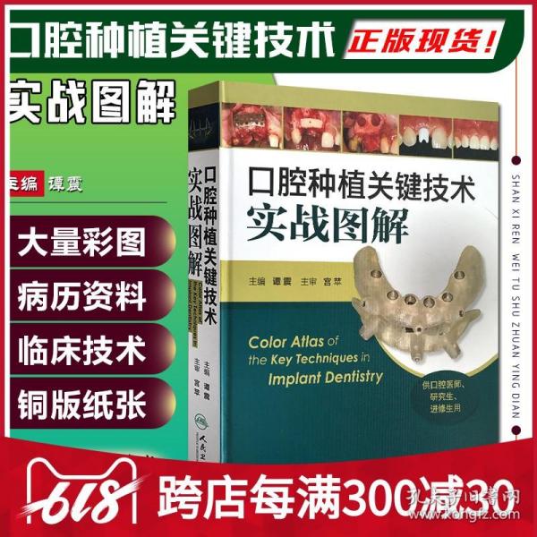 口腔种植关键技术实战图解（供口腔医师、研究生、进修生用）