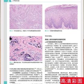 2021新版罗塞和阿克曼外科病理学上下卷册胃肠道和肝胆病理学皮肤病理学头颈部病理学John RGoldblum原著回允中北京大学医学出版社