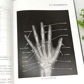 正版包邮 中国儿童手腕部骨龄评测标准CHN法与参考图谱 邵伟东国协和医科大学出版社骨科学参考图谱儿童手腕骨发育标准骨科学书籍