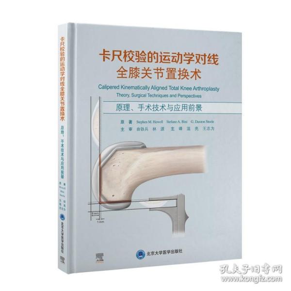 卡尺校验的运动学对线全膝关节置换术——原理、手术技术与应用前景