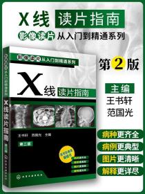 影像读片从入门到精通系列：X线读片指南（第2版）