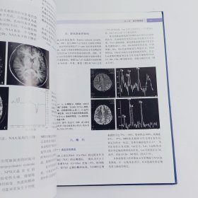 磁共振功能成像临床应用==正版真实现货