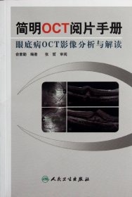 简明OCT阅片手册：眼底病OCT影像分析与解读
