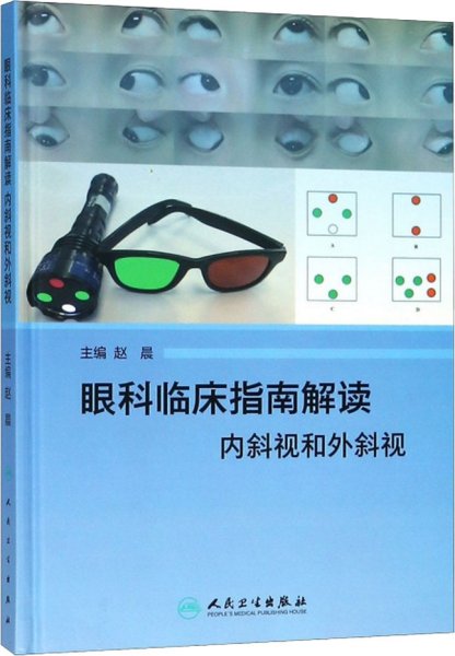 眼科临床指南解读 内斜视和外斜视