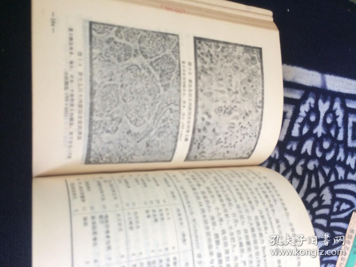 儿科临床疑难病例
