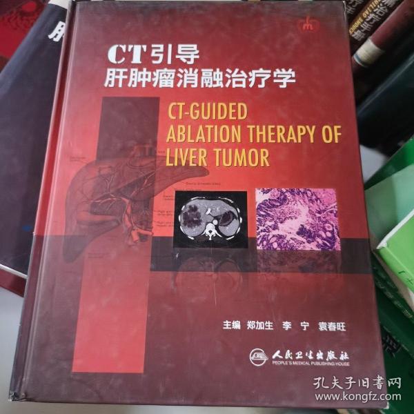 CT引导肝肿瘤消融治疗学（精）