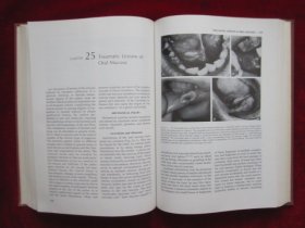 Diseases of the Oral Mucosa（Second Edition）口腔黏膜病学（第2版 货号TJ）