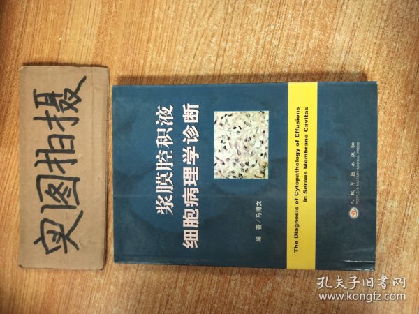 浆膜腔积液细胞病理学诊断