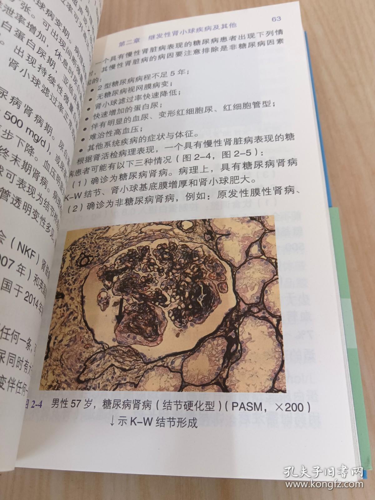 中国慢性疾病防治基层医生诊疗手册  肾脏病学分册