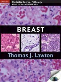 现货 Breast (Cambridge Illustrated Surgical Pathology) [9780521881593]