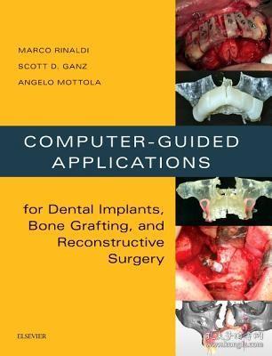 现货 Computer-Guided Applications for Dental Implants, Bone Grafting, and Reconstructive Surgery (Adapted Translation)[9780323278034]