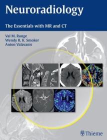 现货 Neuroradiology: The Essentials with MR and CT[9781604069167]