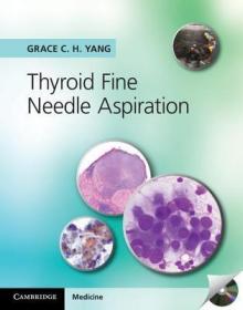 现货 Thyroid Fine Needle Aspiration With Cd Extra [9781107618138]