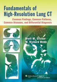 现货Fundamentals of High-Resolution Lung Ct: Common Findings, Common Patterns, Common Diseases, and Differential Diagnosis: Common Findings, Common Patter[9781451184082]