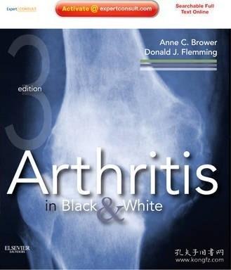 ArthritisinBlackandWhite关节炎的影像学图谱(第三版)英文原版