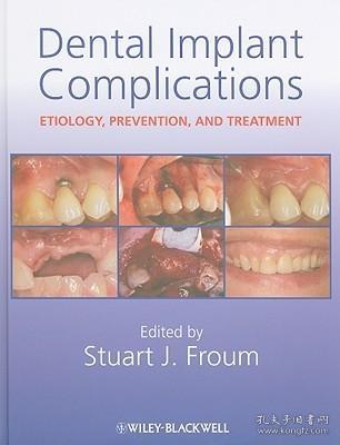 DentalImplantComplications:Etiology,Prevention,andTreatment